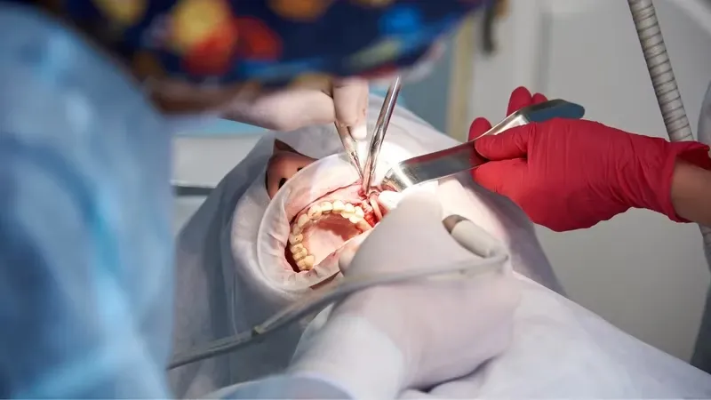 Cách phòng ngừa tình trạng nổi cục cứng ở lợi