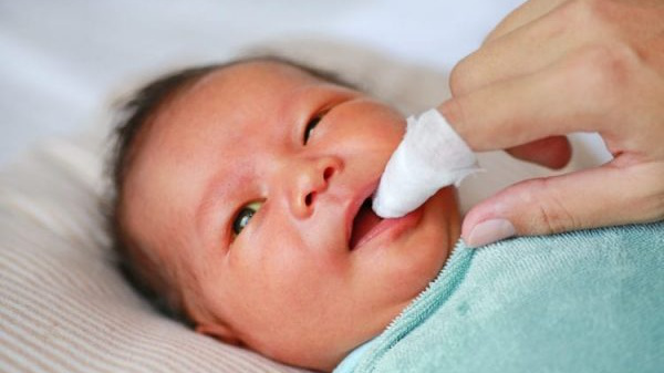 Vòm miệng trẻ sơ sinh bị trắng: Nguyên nhân và cách xử lý 6 Nguyên nhân khiến vòm miệng trẻ sơ sinh bị trắng