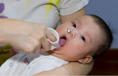 Vì sao trẻ sơ sinh lại có nanh sữa