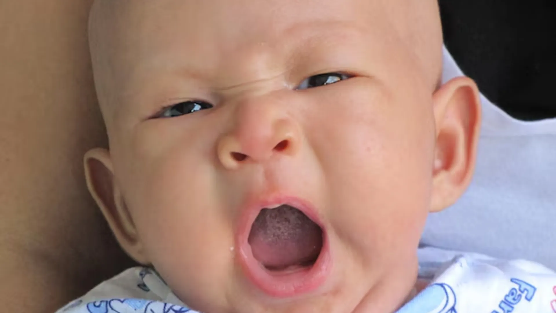 môi bé bị bợn trắng